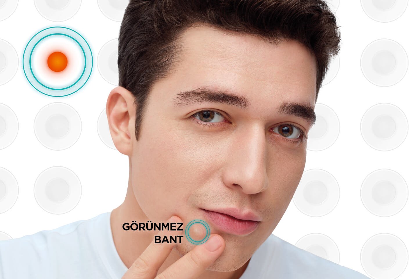 Sivilce Bandı Nedir, Ne İşe Yarar?